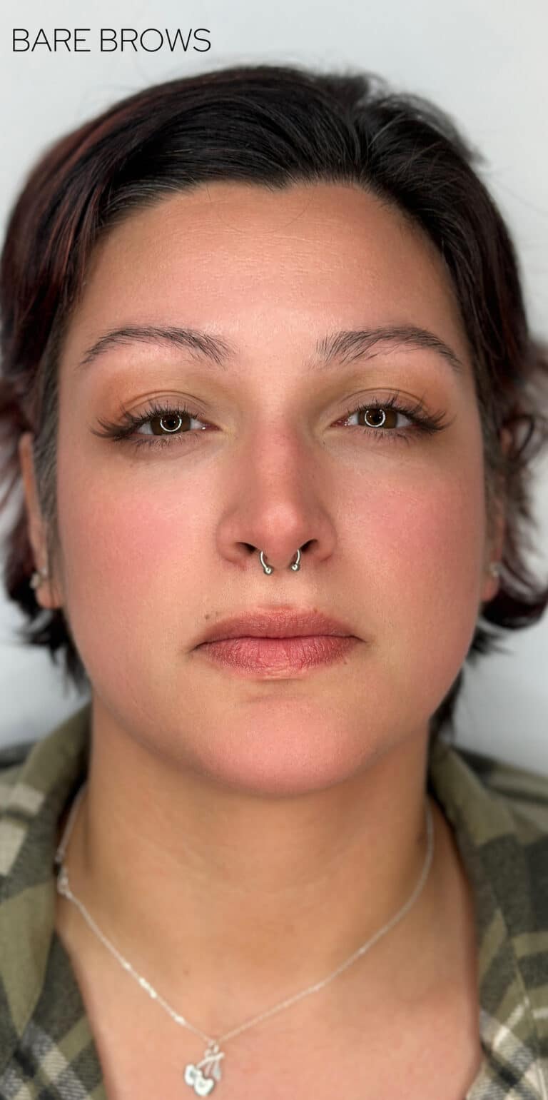 Before Image: Combination Brows - front