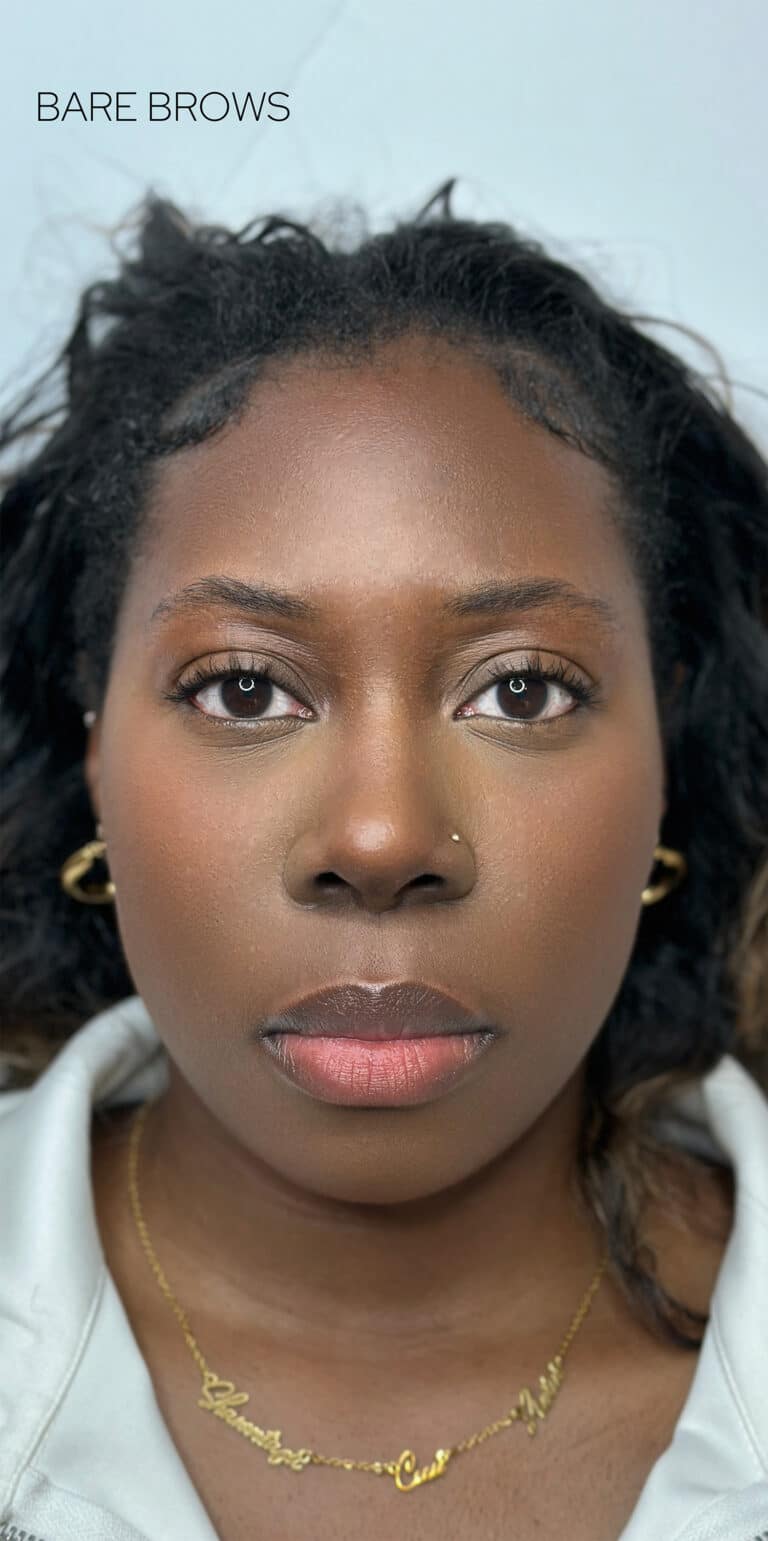 Before Image: Ombre Brows - front